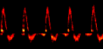 Spectrogram form the aorta